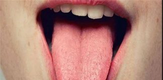 علائم خطرناک بیماری های گوارشی که در دهان بروز می کنند0 (0) علائم خطرناک بیماری های گوارشی که در دهان بروز می کنند