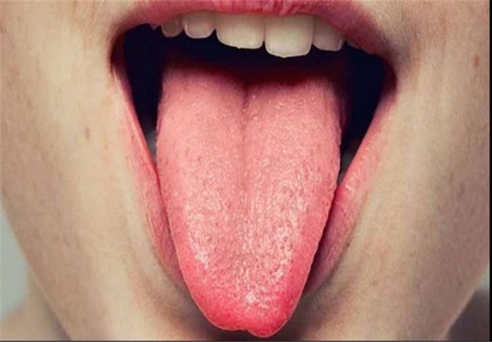 علائم خطرناک بیماری های گوارشی که در دهان بروز می کنند
