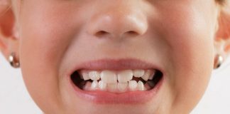 تفاوت اصلی عصب کشی دندان شیری با دائمی که هیچ دندانپزشکی به شما نمی گوید0 (0) تفاوت اصلی عصب کشی دندان شیری با دائمی