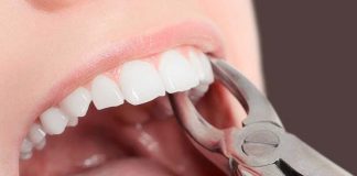 اگر این علائم را دارید باید سریعتر دندان تان را بکشید0 (0) اگر این علائم را دارید باید سریعتر دندان تان را بکشید