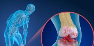 چگونه از پوکی استخوان در جوانی جلوگیری کنیم ؟0 (0) چگونه از پوکی استخوان در جوانی جلوگیری کنیم ؟