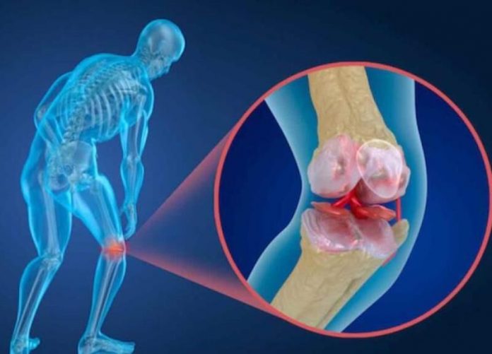 چگونه از پوکی استخوان در جوانی جلوگیری کنیم ؟