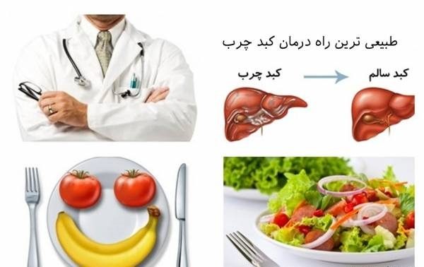 مهمترین و سریعترین درمان کبد چرب مهمترین و سریعترین درمان کبد چرب