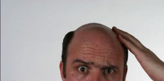 این داروها شما را تا ابد کچل می کنند0 (0) این داروها شما را تا ابد کچل می کنند