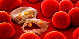 همه چیز در مورد بیماری کشنده سپسیس0 (0) حمله کرونا به قلب